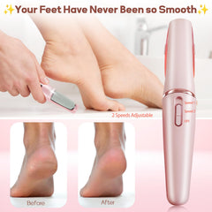 ZABOUL roller heads are washable for easy hygiene after use.