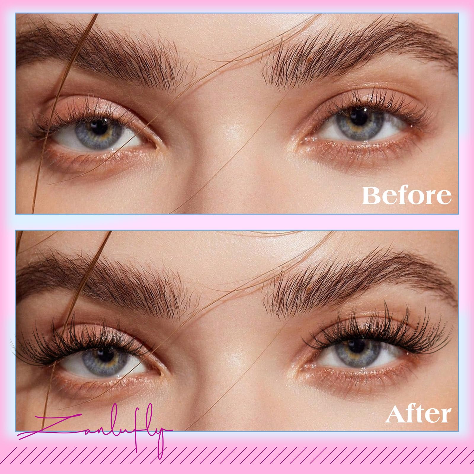 Zanlufly easy remove adhesive for irritation-free removal.