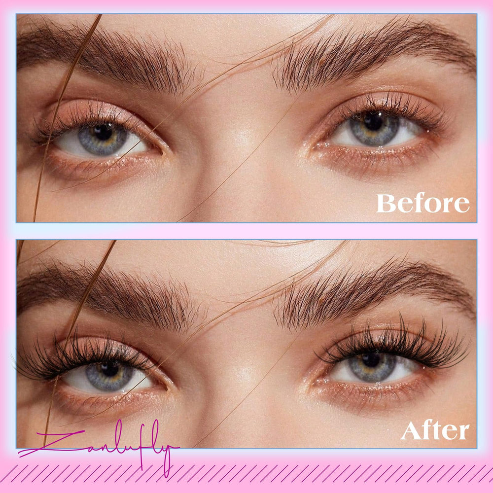 Zanlufly easy remove adhesive for irritation-free removal.