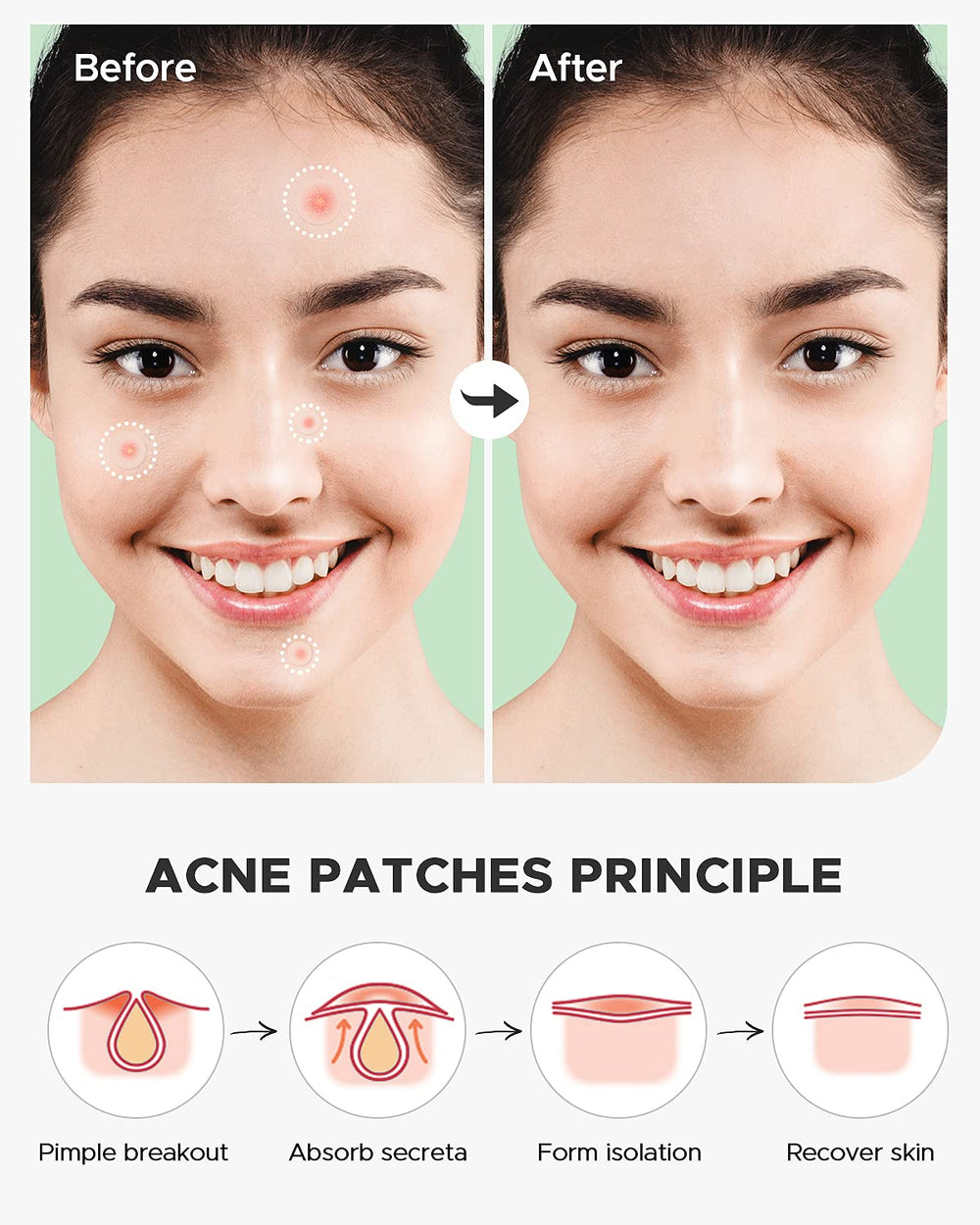ZATKTK patch being applied to a blemish for simple use.