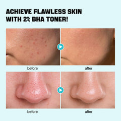 ZealSea Toner textura piel: exfoliación suave para una apariencia más uniforme.