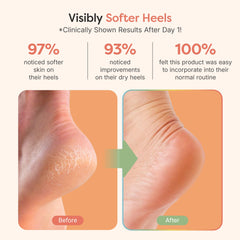 ZenToes talones con gel Aceite de Oliva para nutrición de la piel.