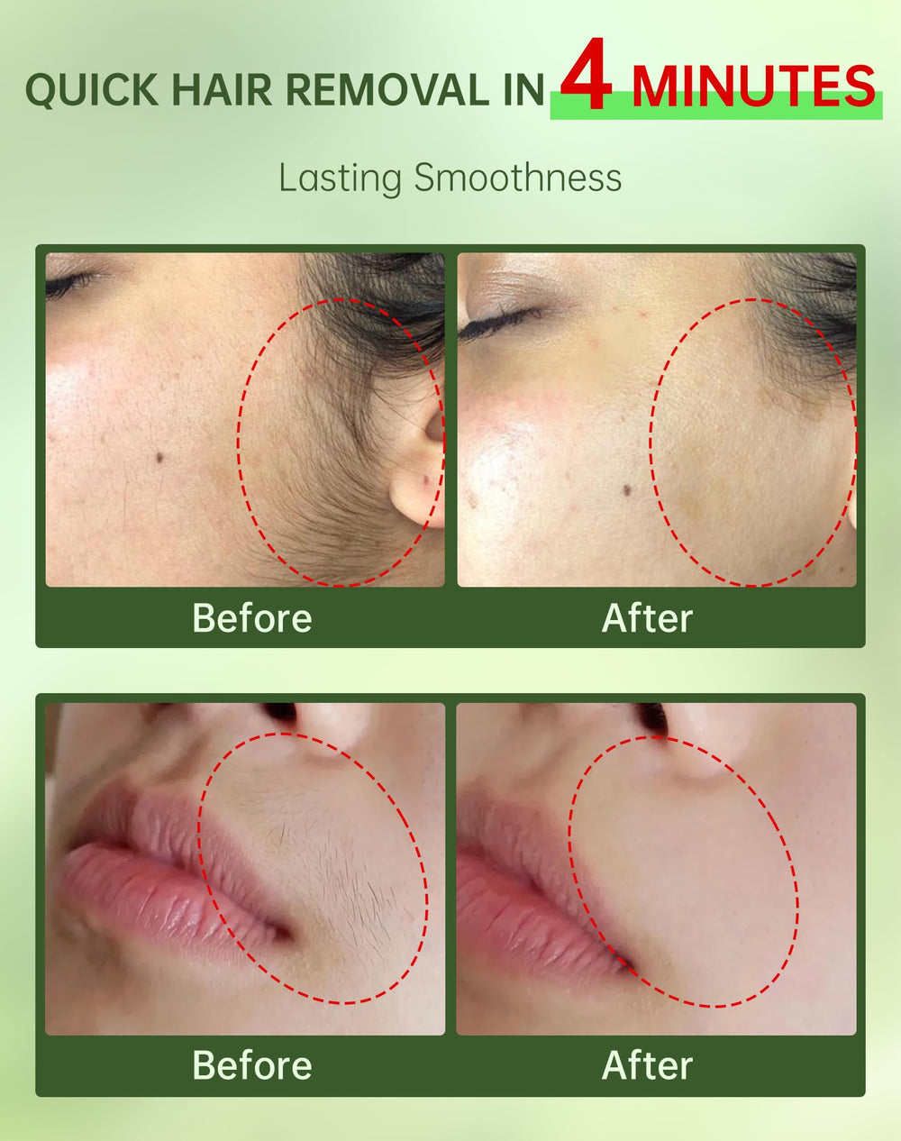 Zeponyx soothing cream with ceramide NP for post-removal calm on sensitive skin.