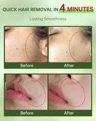 Zeponyx soothing cream with ceramide NP for post-removal calm on sensitive skin.