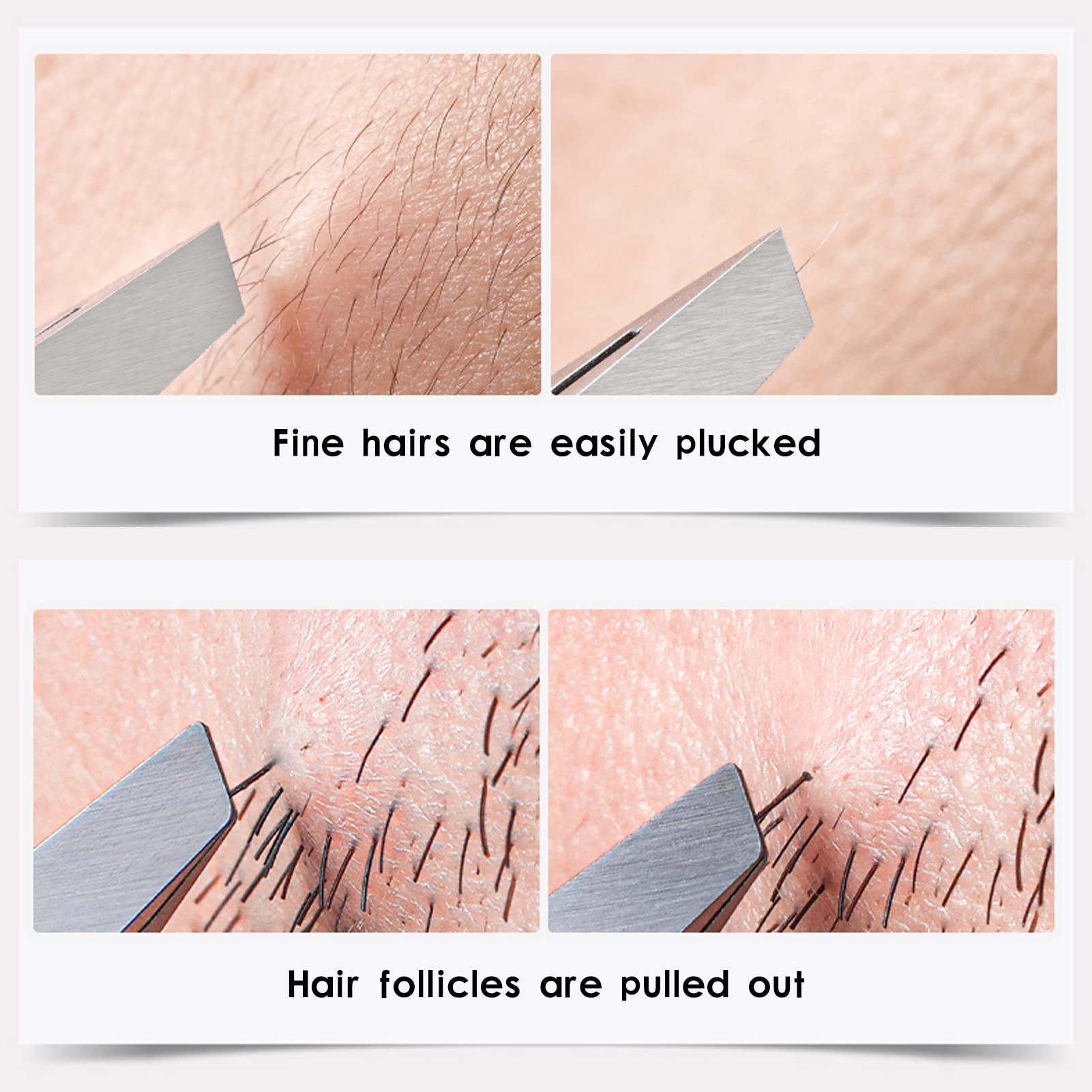 ZERNBER Tweezers Set with etched tips for reliable grip and precision.