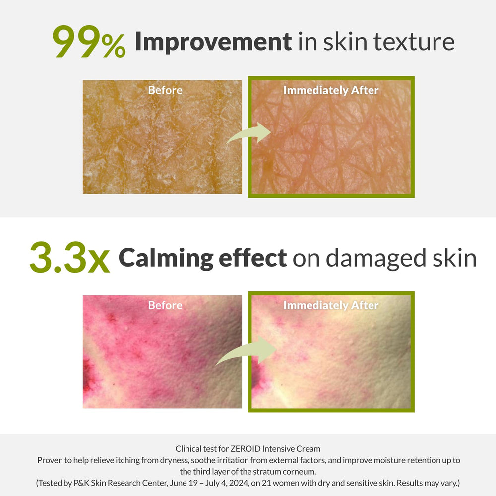 ZEROID Intensive Cream face before after shows smoother, nourished skin