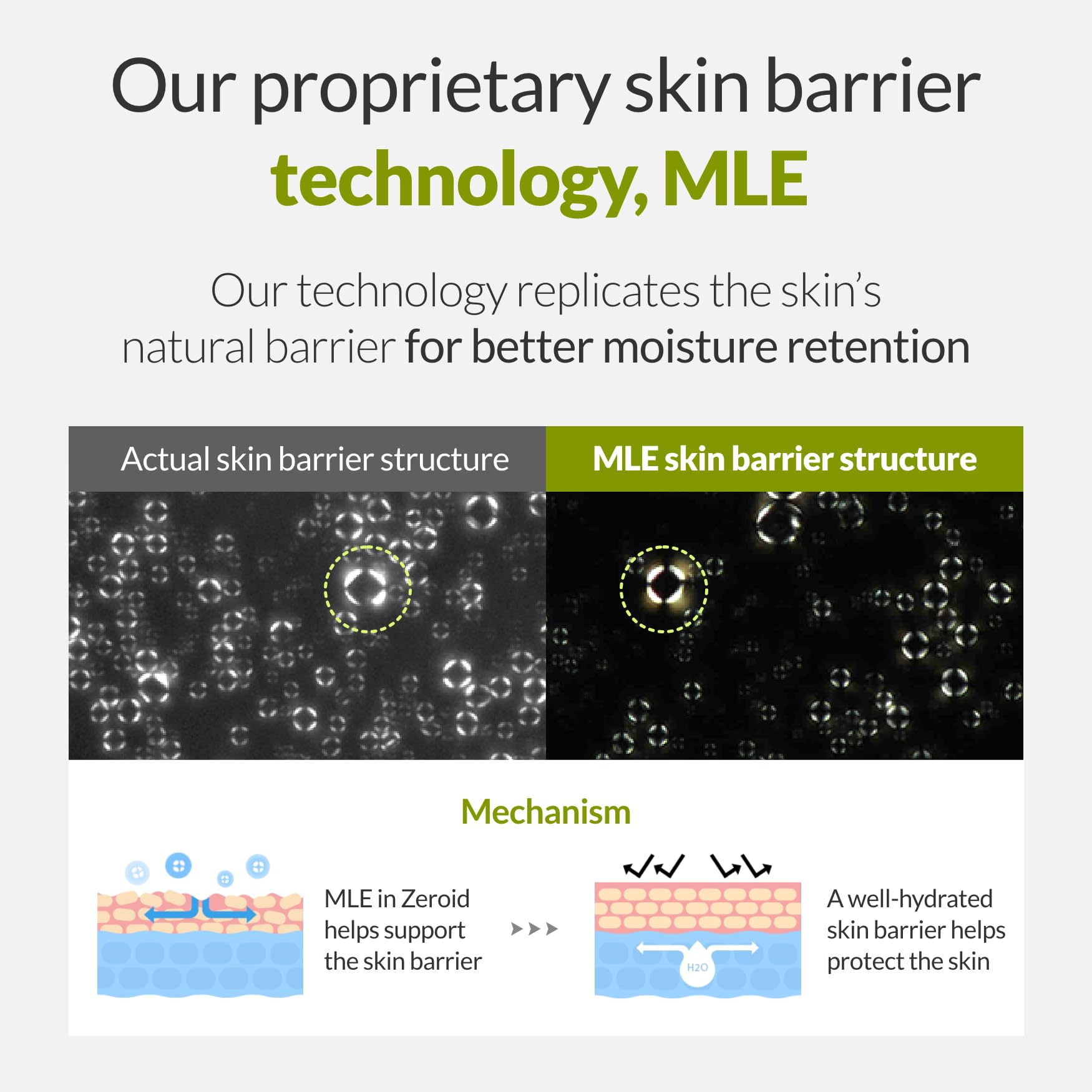 ZEROID Intensive Cream packaging box highlights dermatologist-tested credentials
