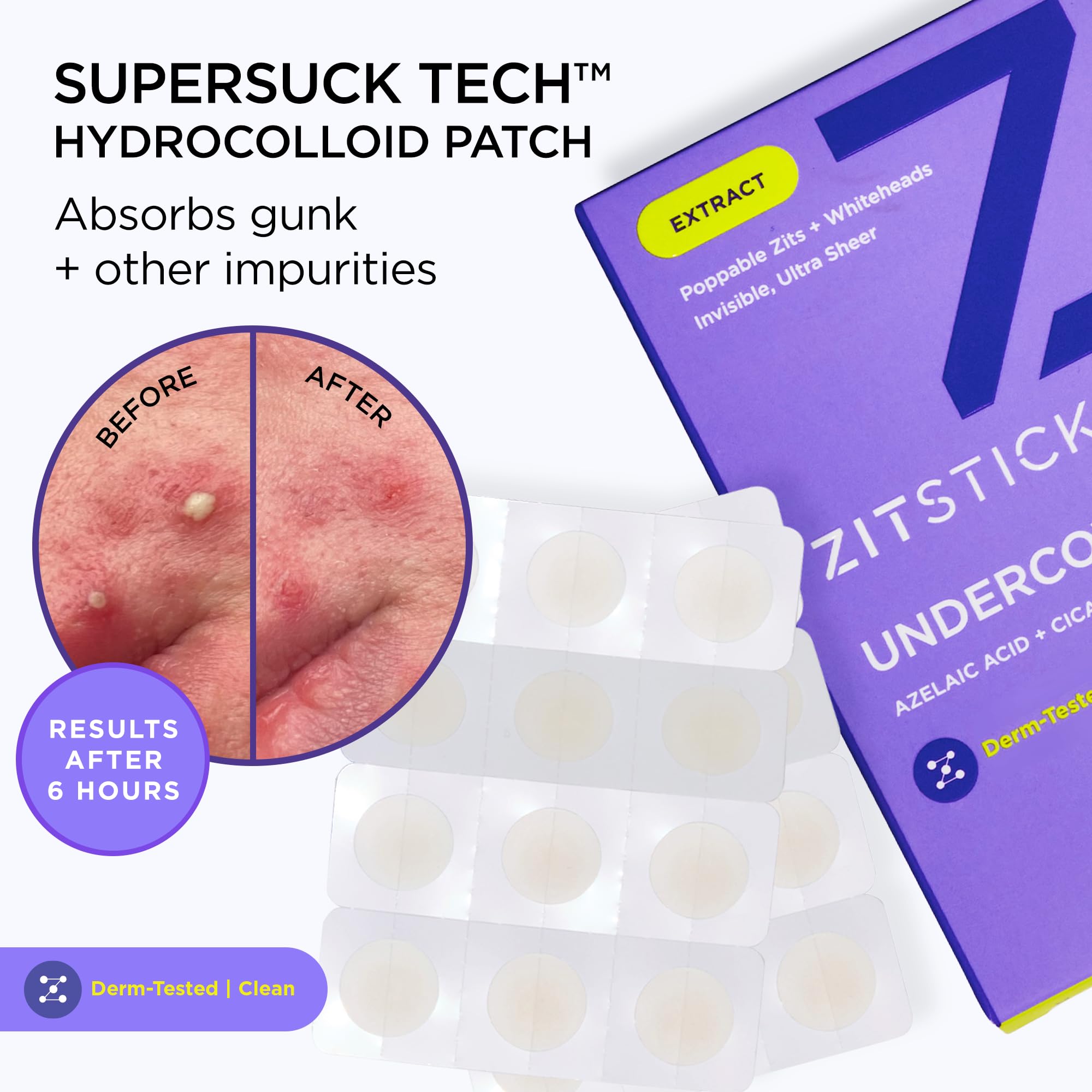ZitSticka apta para piel sensible, suave y respetuosa con la piel.