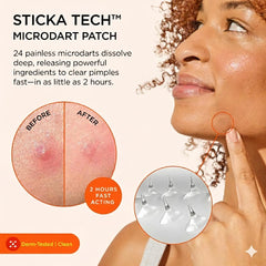 Detalle de microdardos de ZitSticka que liberan activos en el grano.