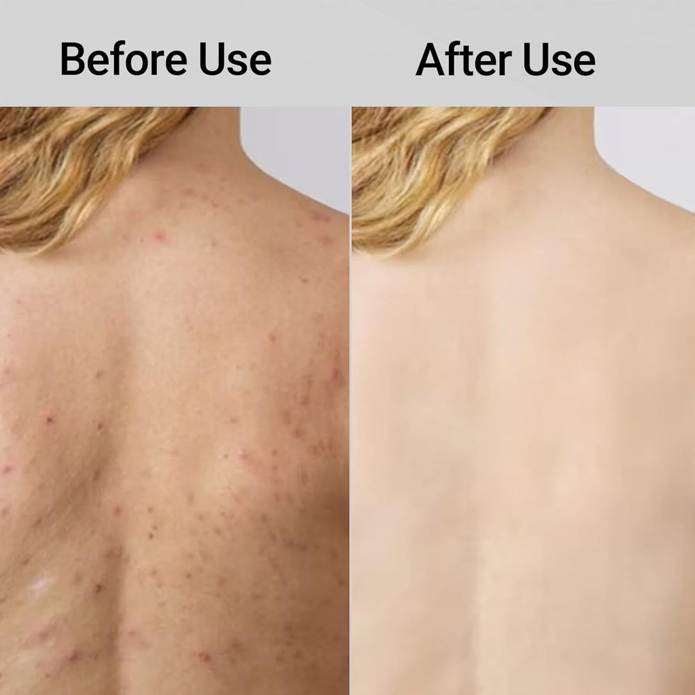 Toalla exfoliante ZIVWAGX, ideal para ritual diario de cuidado corporal.