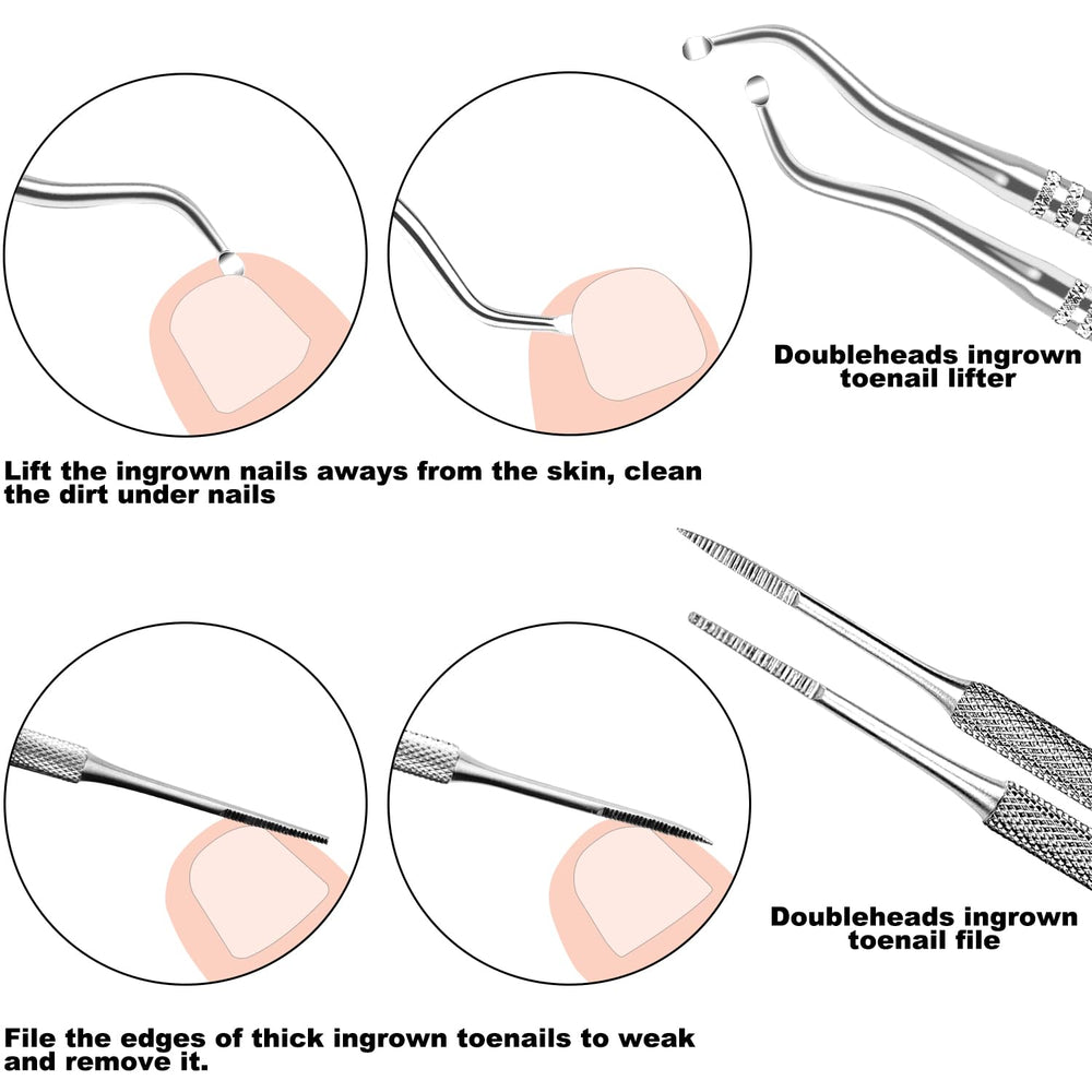 ZIZZON thick toenail file for stubborn edges