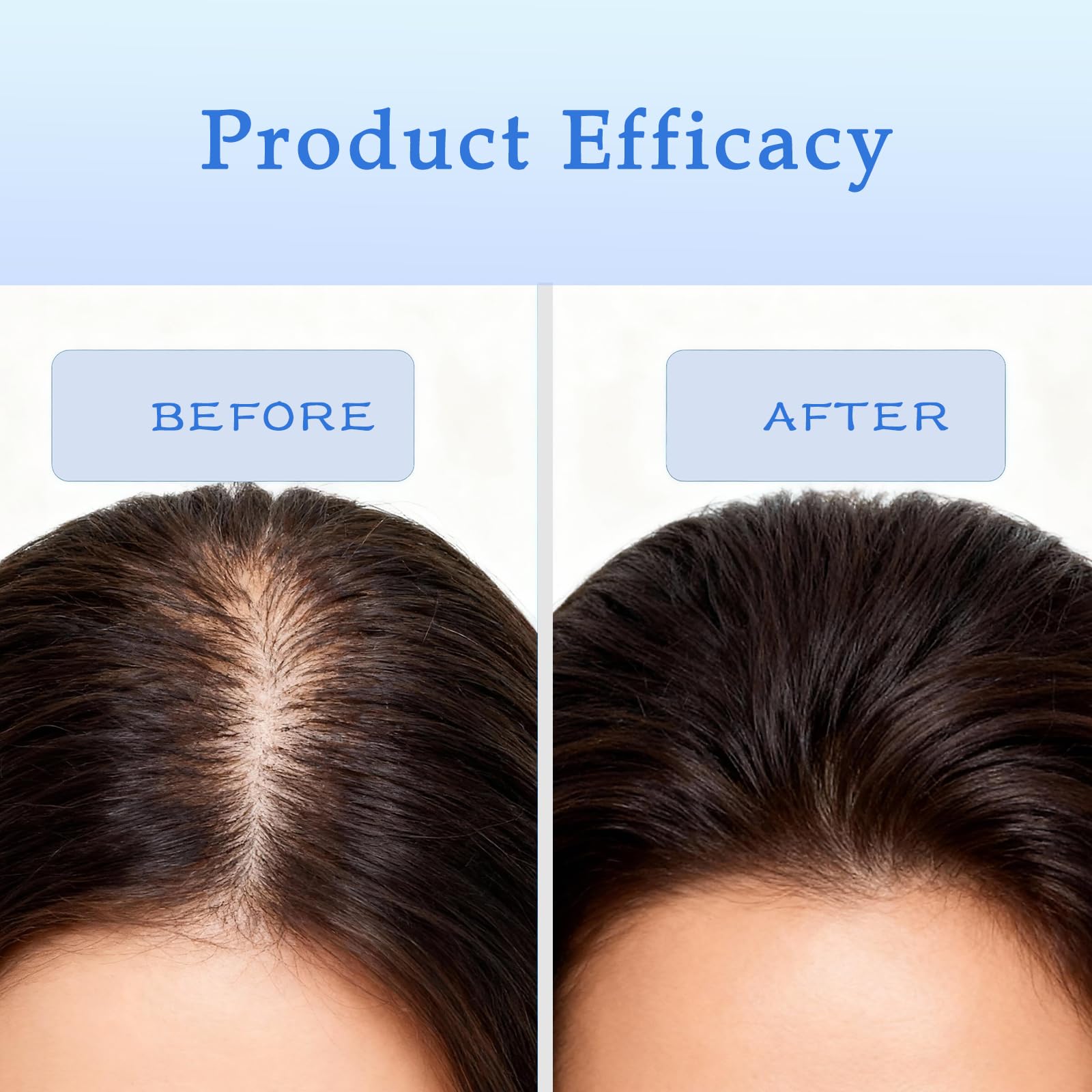ZVMHSPP absorción rápida, cabello más suave y manejable